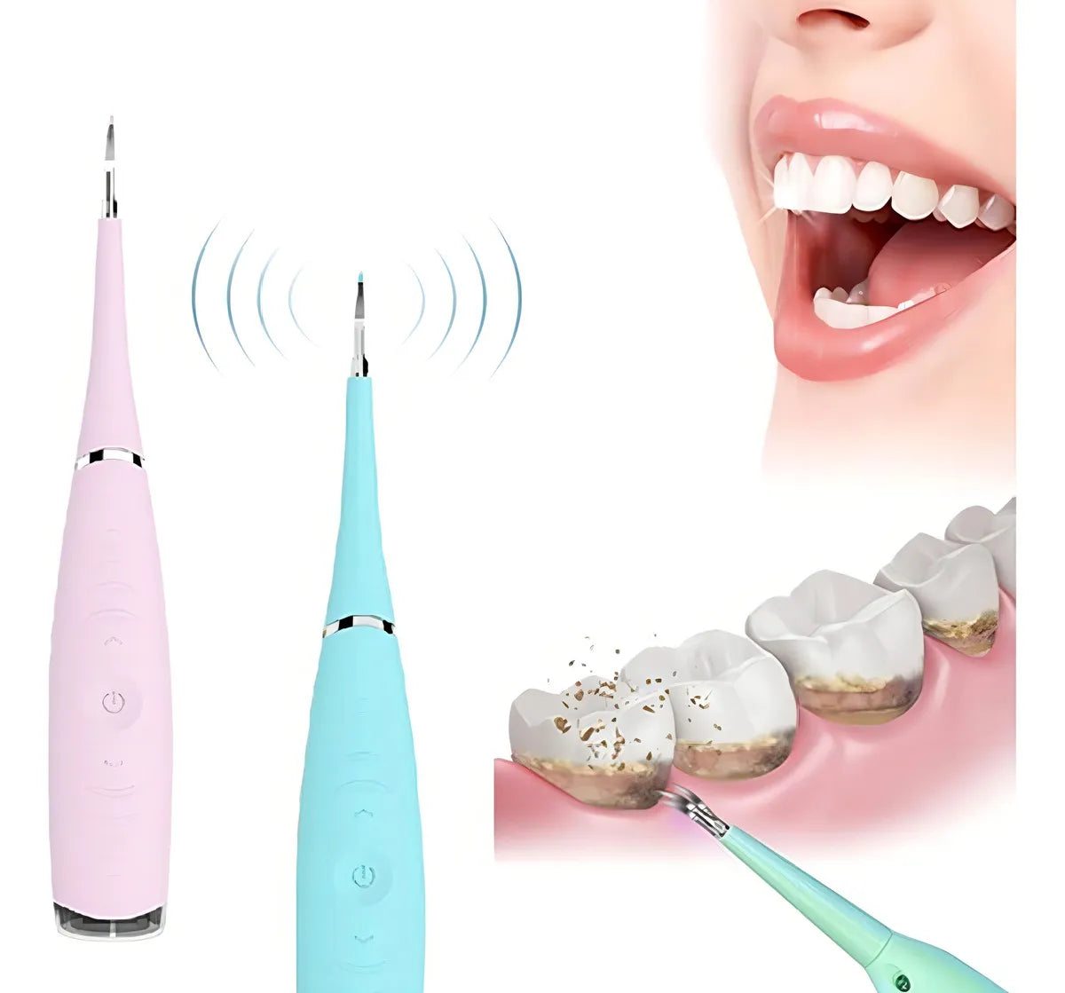 Raspador Dental Ultrasónico Limpiador